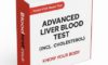 Liver Blood Test Guide for Maidstone Residents