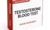 TRT Monitoring: Essential Blood Tests Explained for the UK
