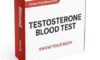 Testosterone Blood Test in Slough: The Essential Guide