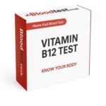 B12 Deficiency Blood Test: Key Facts and Advice in Bath